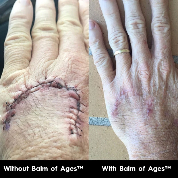 Balm of Ages – Multi-purpose Body Balm & Moisturiser - Image 7