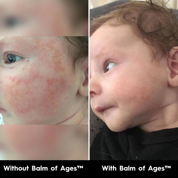 Balm of Ages – Multi-purpose Body Balm & Moisturiser - Image 8