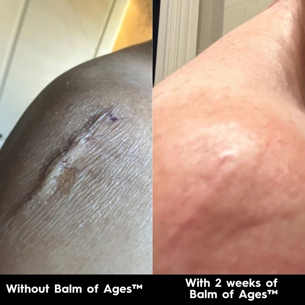 Balm of Ages Mini – Multi-purpose Body Balm & Moisturiser - Image 9